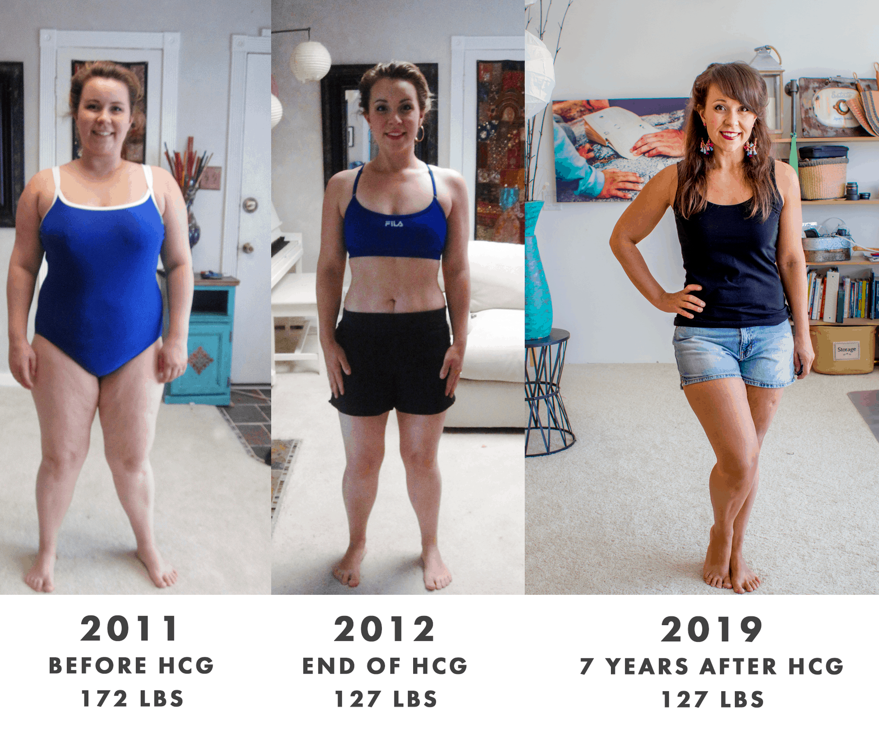 RAYZEL-before-after-hcg
